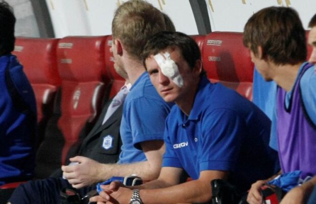 Alexe i-a "scos" ochii lui Simek :S