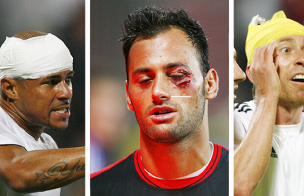 VIDEO şi FOTO Fotbal sau război? » 36 de copci pentru Beto!