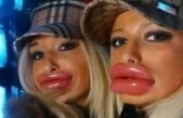 Piţipoanca e "emblemă", vrea botox-ul sus pe stemă! Vezi o galerie foto cu cele mai penibile transformări