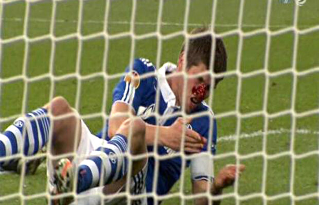 GALERIE FOTO Huntelaar a fost dus de pe teren direct la spital şi operat timp de o oră