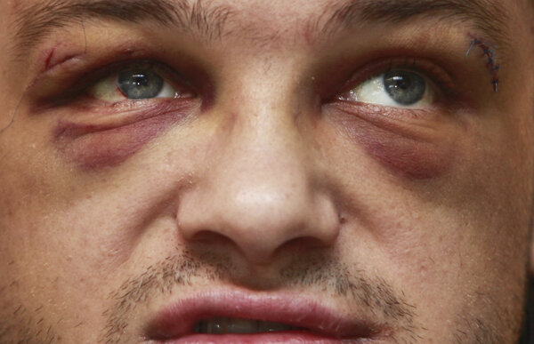 Gazeta l-a vizitat pe JoJo Dan, aflat în convalescenţă, la Trabzon » Soartă de boxer