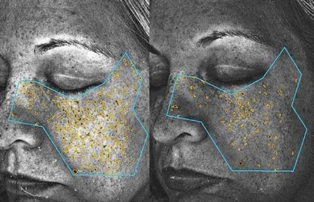 Adio riduri! O băutură inventată de NASA, menită să-i protejeze pe astronauţi, are efecte miraculoase pentru ten