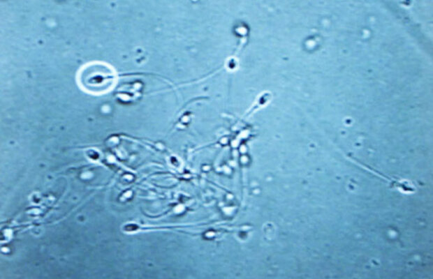 Chiloţii strâmţi afectează sterilitatea bărbaţilor. Dar ţigările, alcoolul şi droguri? (STUDIU)