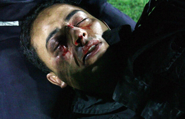 FOTO Fight club! » Week-end teribil în sportul mondial: feţe lovite şi acoperite de sînge