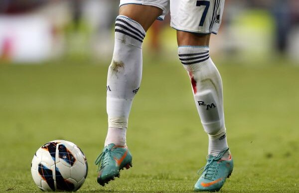 VIDEO Tăiat pe tibie! » Cristiano Ronaldo a terminat sîngerînd meciul cu Celta Vigo (2-0)