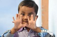 Copilul cu 25 de degete! Trăieşte în India iar părinţii nu doresc să-l opereze pentru a rămâne celebru