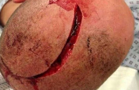 VIDEO Horror League » Violenţe ieşite din comun la meciurile de la Roma şi Marseille