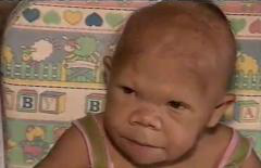 VIDEO. Caz medical incredibil. Are 30 de ani dar arată ca un copil de NOUĂ luni