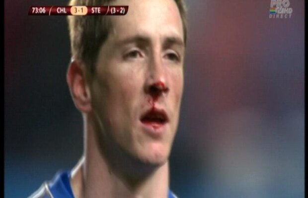 VIDEO şi FOTO Szukala l-a umplut de sînge pe Torres la o fază la care englezii au cerut penalty