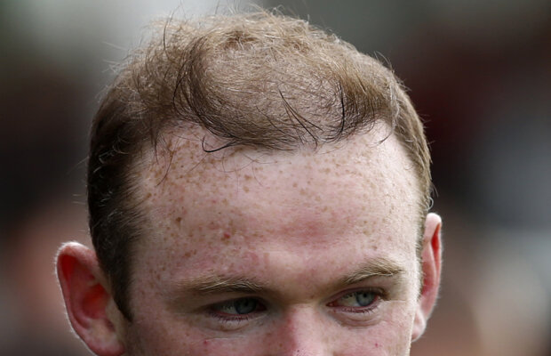 Alt implant! » Wayne Rooney ”suferă” pentru podoaba capilară: 9 ore în operaţie!