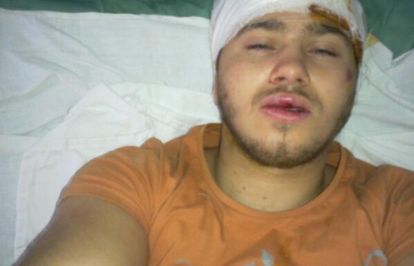 Un boxer din Deva, fost bronz la Europene, a fost bătut măr de ţigani: "Mi-au dat un bolovan în cap"