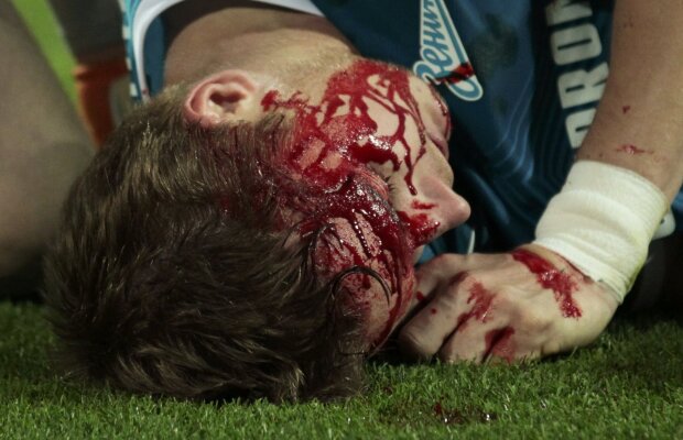 FOTO şi VIDEO Liga horror » Imagini dure: Valencia şi Hubocan au ieşit de pe teren ca după un meci de K1