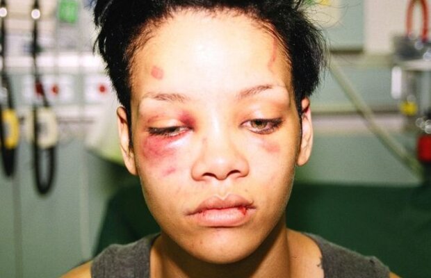 FAKE sau real? Şocant! Mesajul uluitor postat de Rihanna după înfrîngerea Braziliei! :O