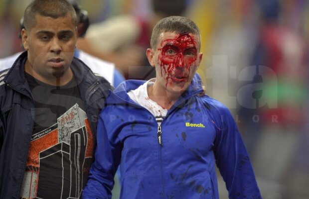 Reconstituirea evenimentelor petrecute în peluza Nord a arenei: "Bătăuşii vor fi pedepsiţi!"