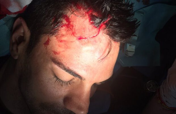 Rănit de război » Urko Pardo a rămas incoștient după un duel cu un adversar:  15 puncte de sutură la frunte