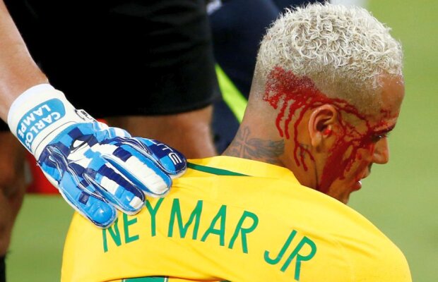 GALERIE FOTO + VIDEO Imagini horror » Neymar a fost umplut de sânge de un adversar!