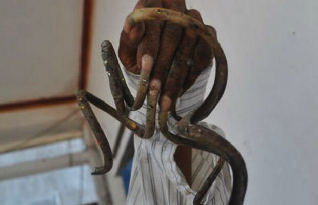 VIDEO » Un bărbat nu şi-a mai tăiat unghiile de 35 de ani. Iată cum arată