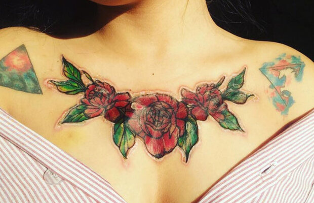 FOTO Te cutremuri! Și-a îndepărtat un tatuaj infectat, iar ce a rămas e înfiorător. Atenție, imagini cu impact emoțional