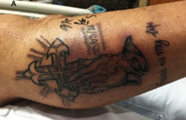 Incredibil! Un bărbat a murit din cauza unui tatuaj!