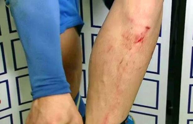 Urmările intrării horror a lui Cânu la Bărbulescu: "Mai avea puțin și-mi rupea ambele picioare"