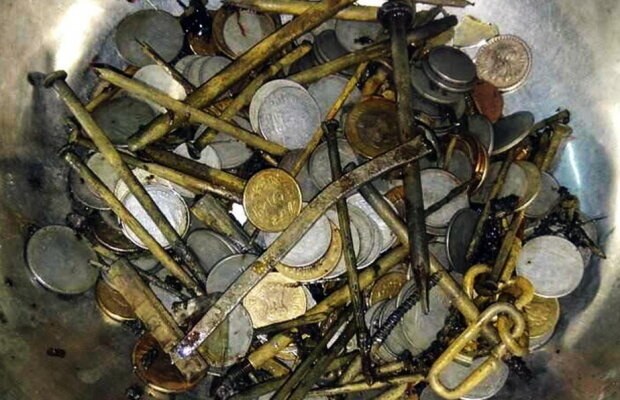 FOTO Medicii au fost şocaţi când au văzut ce are în stomac un bărbat din India!