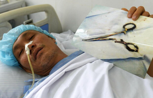 Incredibil! A trăit 18 ani cu o foarfecă în stomac