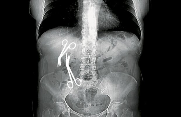 INVESTIGAȚIE Libertatea / Directorul medical al Spitalului Militar din Constanța a uitat două foarfeci de 16 cm în burta unei paciente de 61 de ani!