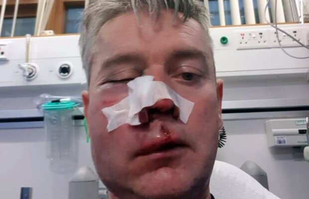 FOTO Imagine dură: 3 jucători și un suporter l-au desfigurat pe arbitru! "Nu poate vorbi, nu poate mânca. Bea doar cu paiul"