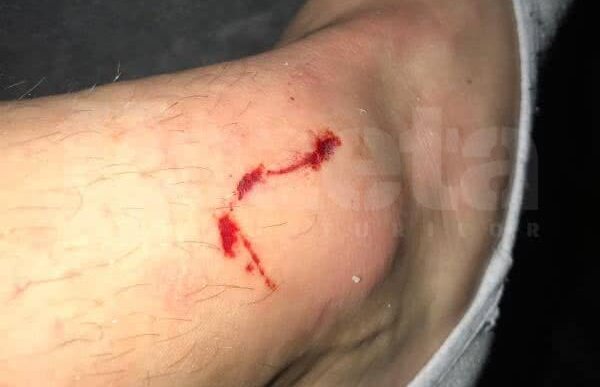 VIITORUL - BOTOȘANI 1-0 // FOTO EXCLUSIV Cum arată piciorul lui Golofca după intrarea dură a lui Ianis Hagi 