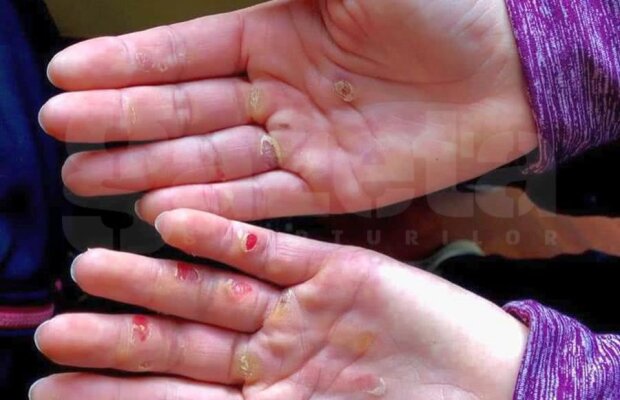 FOTO Imagine sfâșietoare: cum arată palmele unei canotoare după 3 luni de cantonament » Interviu-eveniment cu Ionela Cozmiuc