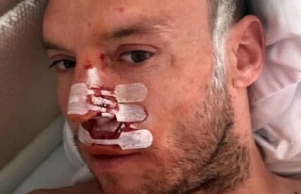 ASTRA GIURGIU  - CFR CLUJ // FOTO Cristi Bud și-a spart nasul în ziua returului semifinalei din Cupa României. Atacantul era anunțat titular de Dan Petrescu