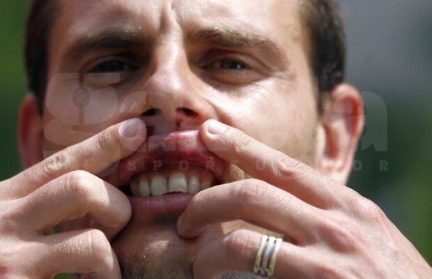 EXCLUSIV VIDEO Bătaie în vestiarul unei foste echipe de Liga 1: „A fost o altercație la baie” / „Mi-au spart dinții și mi-au rupt coastele”