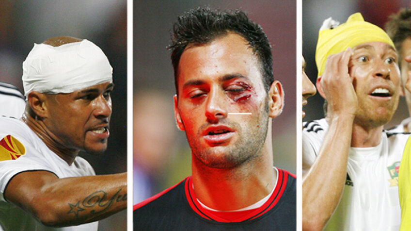 Wesley, Beto şi Adailton au părăsit însîngeraţi 