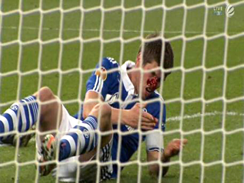 Accidentări grave suferite de Huntelaar (Schalke) şi de Schweinsteiger  (Bayern) Foto: Reuters