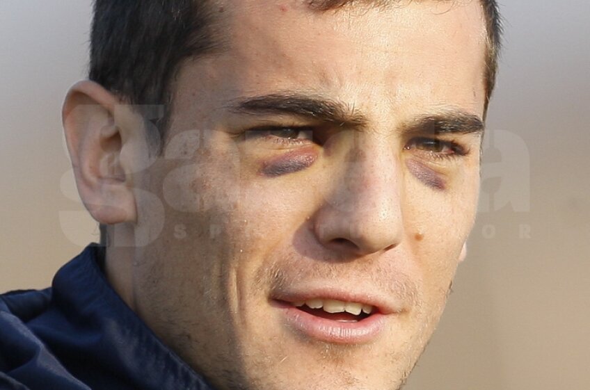 Steliştii au revenit la antrenamente. Nikolici a venit cu faţa plină de vînătăi