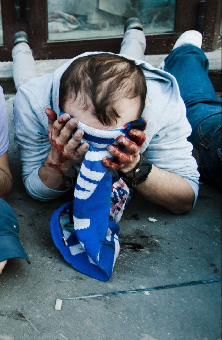 Iubirea
pentru
Craiova și
mîinile
însîngerate
ale unui
suporter
Foto Intact
Images