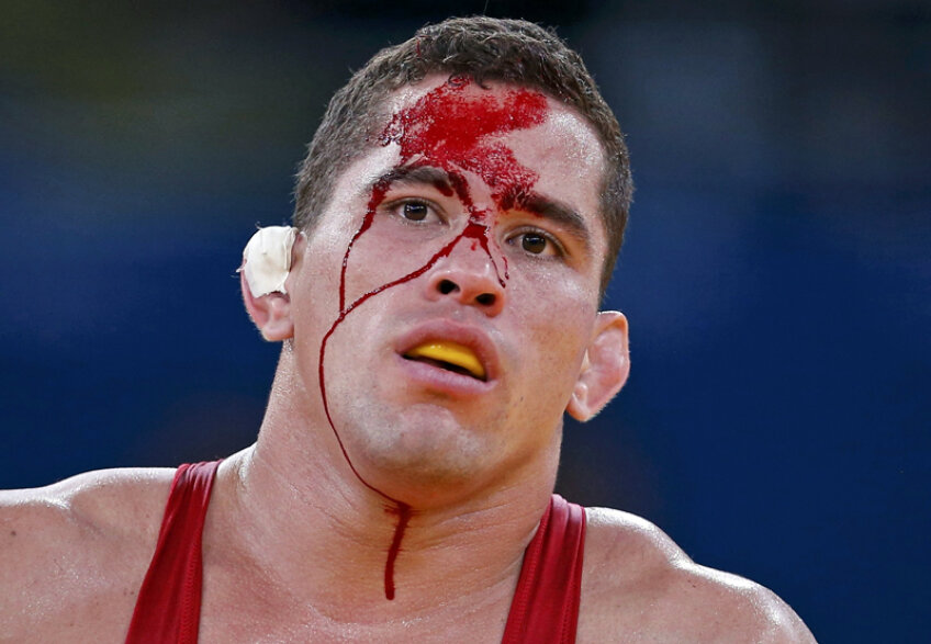 Traseul de sînge. Rîurile roşii s-au unit pe faţa luptătorului venezuelean Ricardo Moreno // Foto: Reuters