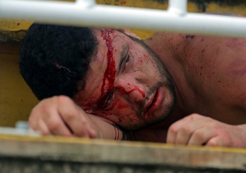 Sîngele îi brăzdează fruntea. De-abia mai deschide ochii. E zdrobit // Foto: MediafaxFoto/AFP