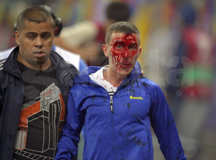 Imaginea fanului însîngerat a
fost preluată de site-uri
sportive din întreaga lume: au
fost atacați și copii sau femei Foto: Ștefan Constantin