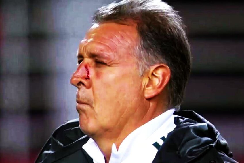 Gerardo Martino s-a rănit în zona nasului