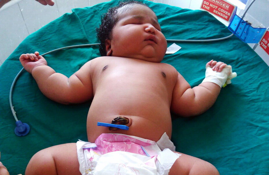 S-a născut fetiţa cu cea mai mare greutate din lume ► Foto: metro.co.uk