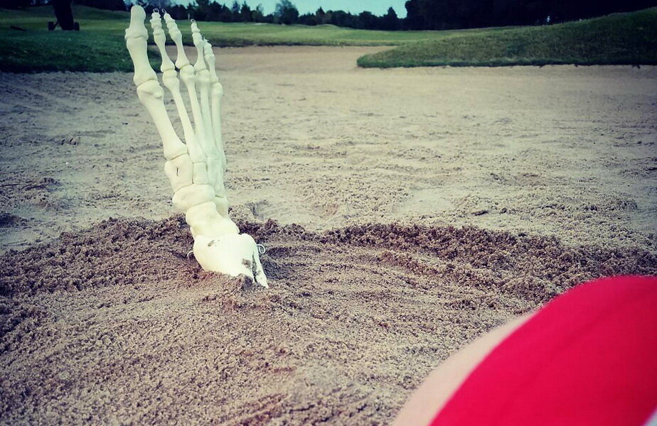 Un picior amputat are propriul cont de Instagram ► Foto: Instagram
