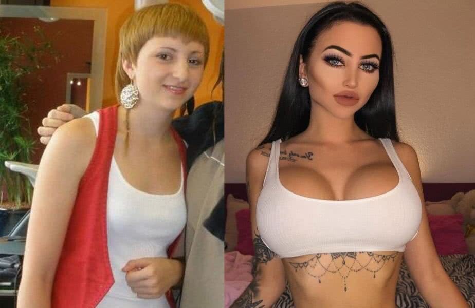 Celine Centino, înainte și după operație